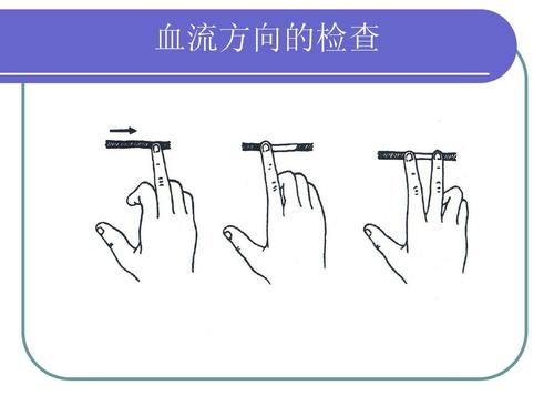 超聲經(jīng)顱多普勒對顱內血流方向的檢查